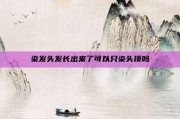 染发头发长出来了可以只染头顶吗